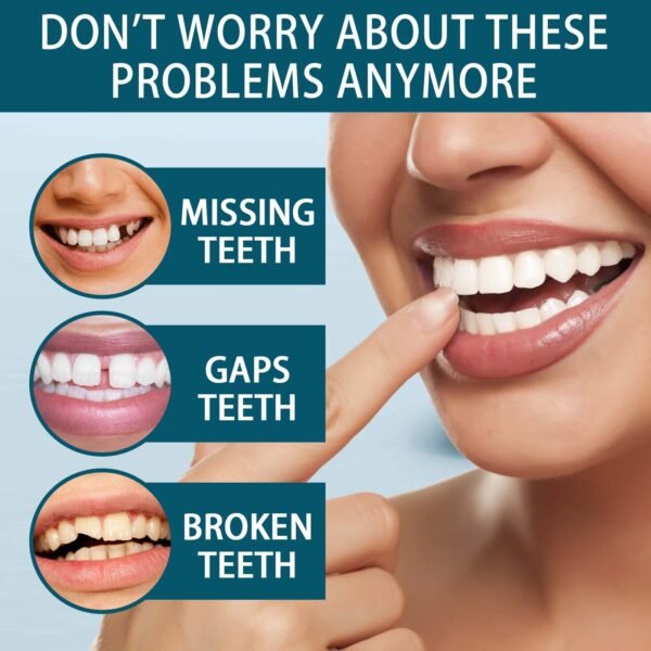 Adjustable Buckle Dentures - Image 4