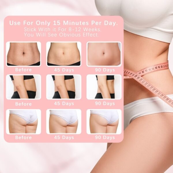 Electric Fat Removers Are Suitable For Situations Where There Is Excessive Fat Accumulation In Various Parts Of The Body Such As The Abdomen, Legs, Arms, Etc. - Image 2