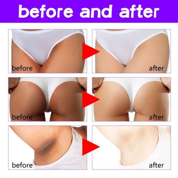 OUHOE Inner Thigh Skin Perfecting Cream Lightens Melanin Deposits On Inner Thighs, Moisturizes And Brightens Skin - Image 4
