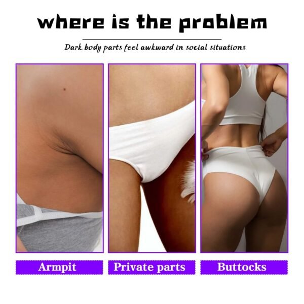 OUHOE Inner Thigh Skin Perfecting Cream Lightens Melanin Deposits On Inner Thighs, Moisturizes And Brightens Skin - Image 6