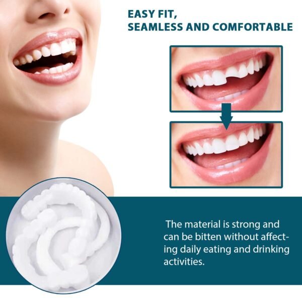Adjustable Buckle Dentures - Image 3