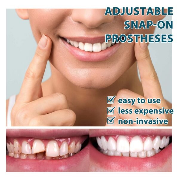 Adjustable Buckle Dentures - Image 5